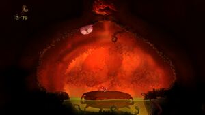 My Heartburn's for You 11.jpg