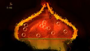 My Heartburn's for You 18.jpg